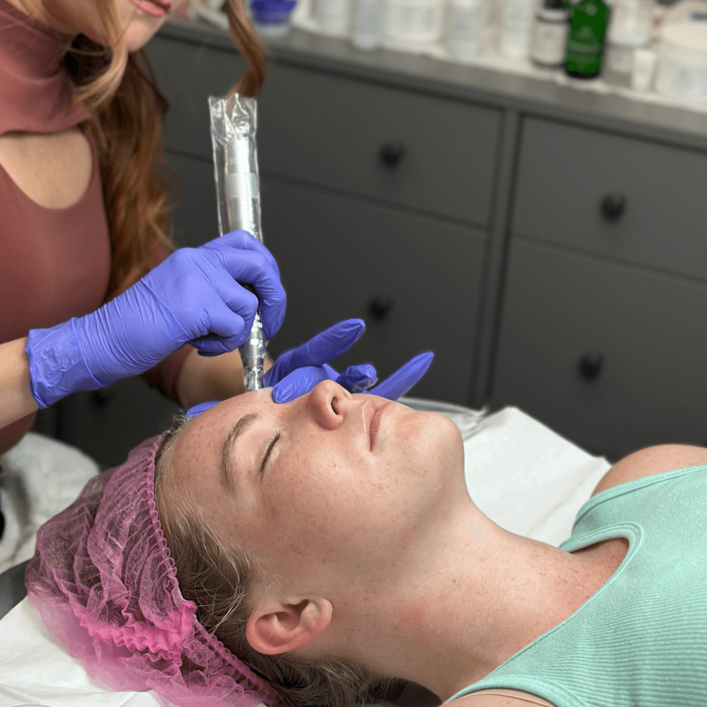 Collagen Induction Therapy (CIT) / Micro-needling + Nano-Infusion