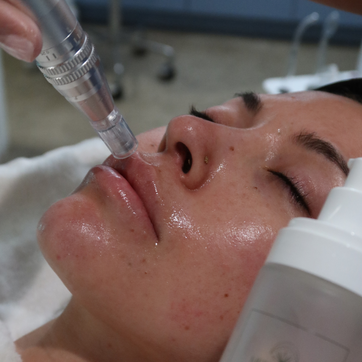 Advanced Hands-On Microneedling + Nano-Infusion Certification