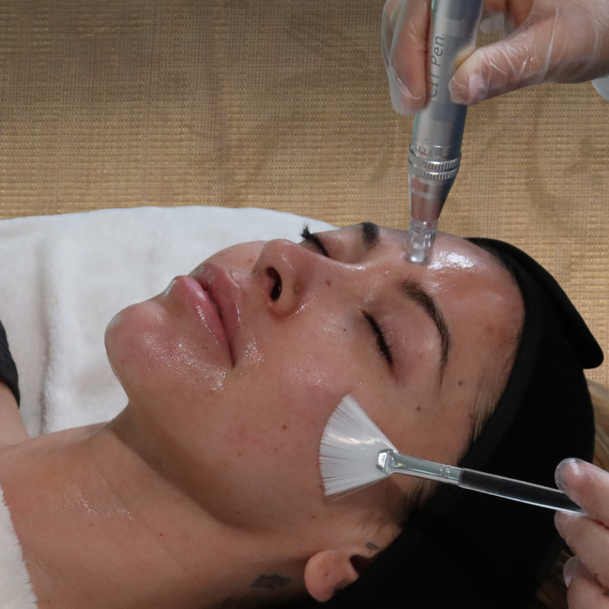 Advanced Hands-On Microneedling + Nano-Infusion Certification