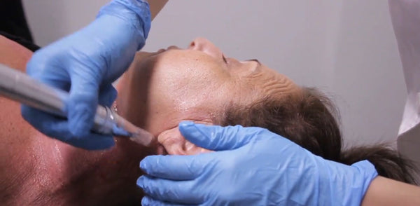 Collagen Induction Therapy (CIT) / Micro-needling + Nano-Infusion